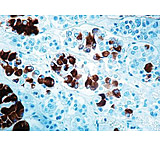 Image of Diagnostic Biosystems Acth CONC. Mab MOB 244