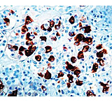 Image of Diagnostic Biosystems Acth Rtu Polyclonal Ab PDR 022