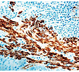 Image of Diagnostic Biosystems Actin Alpha Smooth Muscle Mab MOB 001