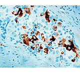 Image of Diagnostic Biosystems Afp - Rabbit .5ML RP 001-05