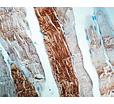 Image of Diagnostic Biosystems Alpha Actinin CONC. Mab MOB 227