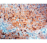 Image of Diagnostic Biosystems Amyloid A Component Rtu Mab PDM 118