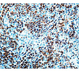 Image of Diagnostic Biosystems BCL-2 Oncoprotein Cln 124 .5ML MOB 005-05