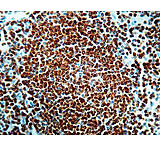 Image of Diagnostic Biosystems BCL-2 Oncoprotein CONC. Mab MOB 130