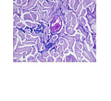 Image of Diagnostic Biosystems C.E.M. Kit 100RXN KT 004