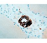 Image of Diagnostic Biosystems Calcitonin Rtu Polyclonal Ab PDR 024