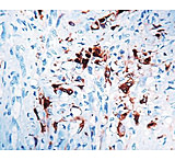 Image of Diagnostic Biosystems Calretinin - Rabbit .5ML RP 043-05