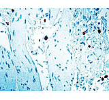 Image of Diagnostic Biosystems Caspase 8 CONC. Polyclonal Ab RP 097
