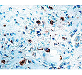 Image of Diagnostic Biosystems Cathepsin D - Rabbit .5ML RP 004-05