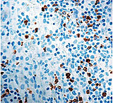 Image of Diagnostic Biosystems CD15 Rtu Mab PDM 127