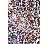 Image of Diagnostic Biosystems CD3 Rtu Mab PDM 126