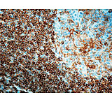 Image of Diagnostic Biosystems CD45RA B Cell Clone 4KB5 .5ML MOB 041-05