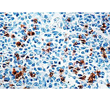 Image of Diagnostic Biosystems CD57 HNK-1 - Clone NK-1 .5ML MOB 163-05