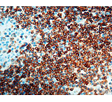 Image of Diagnostic Biosystems CD79A B Cell CONC. Mab MOB 242