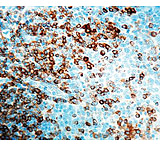 Image of Diagnostic Biosystems CD79A CONC. Polyclonal Ab RP 101