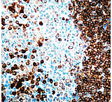 Image of Diagnostic Biosystems CD79A Rtu Rabbit Mab RMPD 014