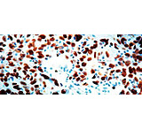 Image of Diagnostic Biosystems CDC47 - Clone 47DC141 .5ML MOB 340-05