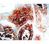 Image of Diagnostic Biosystems Cea - Rabbit .5ML RP 003-05