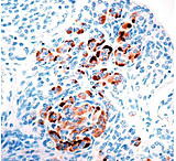 Image of Diagnostic Biosystems Chromogranin A Rtu Rabbit Mab RMPD 015