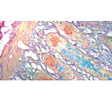Image of Diagnostic Biosystems Colloidal Iron Kit 100RXN KT 007
