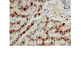 Image of Diagnostic Biosystems Copper Stain Kit 100RXN KT 033