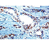 Image of Diagnostic Biosystems Cyclin D1 - Clone DCS-6 .5ML MOB 178-05
