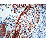Image of Diagnostic Biosystems Cytokera AE1+AE3 AE1+AE3 .5ML MOB 190-05