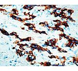 Image of Diagnostic Biosystems Ema - Clone E29 .5ML MOB 401-05