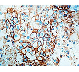 Image of Diagnostic Biosystems Epithelial Antigen VU-1D9 .5ML MOB 062-05