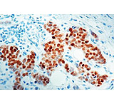 Image of Diagnostic Biosystems Estrogen Receptor CONC. Pab RP 141