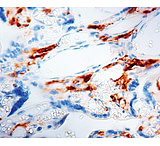 Image of Diagnostic Biosystems Factor Xiiia CONC. Pab RP 103