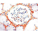 Image of Diagnostic Biosystems Fibronectin - Rabbit .5ML RP 013-05