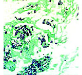 Image of Diagnostic Biosystems G.M.S. Kit 100RXN KT 015