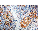 Image of Diagnostic Biosystems GAD65 - Rabbit .5ML RP 075-05