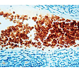 Image of Diagnostic Biosystems Glycophorin A Clone JC159 .5ML MOB 066-05