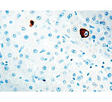 Image of Diagnostic Biosystems Hbsag CONC. Mab MOB 125