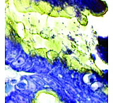 Image of Diagnostic Biosystems Helico Stat Kit 100RXN KT 019