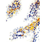 Image of Diagnostic Biosystems Heregulin - Clone 7D5 .5ML MOB 343-05
