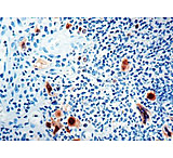 Image of Diagnostic Biosystems Hsv I CONC. Polyclonal Ab RP 018