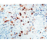 Image of Diagnostic Biosystems Hsv Type Ii Rtu Mab PDM 081