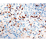 Image of Diagnostic Biosystems Kappa Light Chain CONC. Pab RP 025