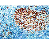 Image of Diagnostic Biosystems KI-67 Antigen CONC. Mab MOB 237