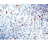 Image of Diagnostic Biosystems Lambda Light Chain CONC. Mab MOB 201