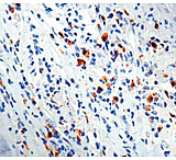 Image of Diagnostic Biosystems Lambda Light Chain Rabbit .5ML RP 027-05
