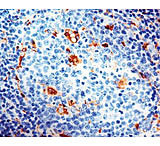 Image of Diagnostic Biosystems CD68 Macrophage Rtu Mab PDM 065