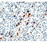 Image of Diagnostic Biosystems Macrophage - Clone MAC387 .5ML MOB 203-05