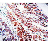 Image of Diagnostic Biosystems MLH-1 - Clone G168-15 .5ML MOB 430-05