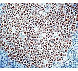 Image of Diagnostic Biosystems MSH2 - Clone 25D12 .5ML MOB 332-05