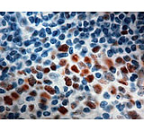 Image of Diagnostic Biosystems MSH6 Clone 44 PDM 147