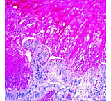 Image of Diagnostic Biosystems Mucicarmine Kit 100RXN KT 024
